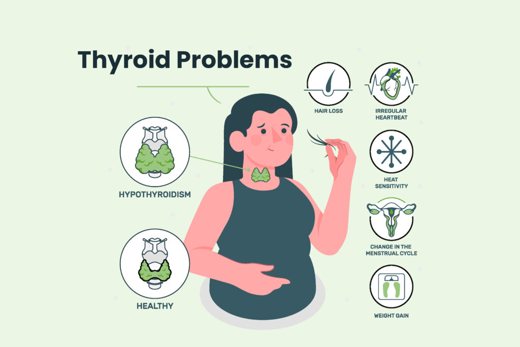 natural remedies for Thyroid Problems